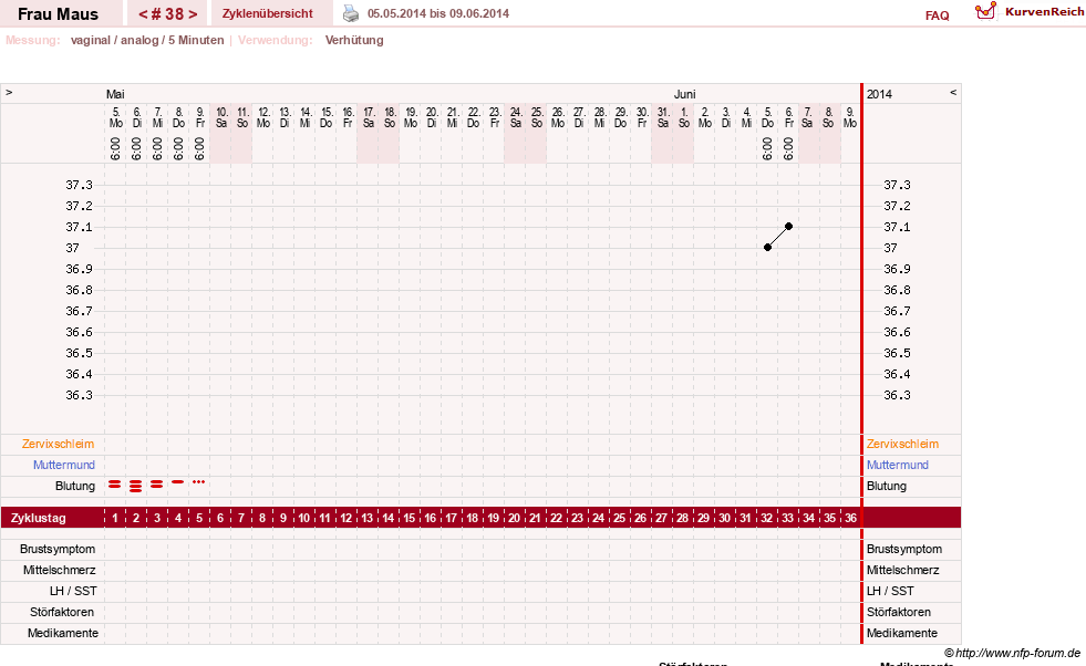 NFP-Kurve User #12121