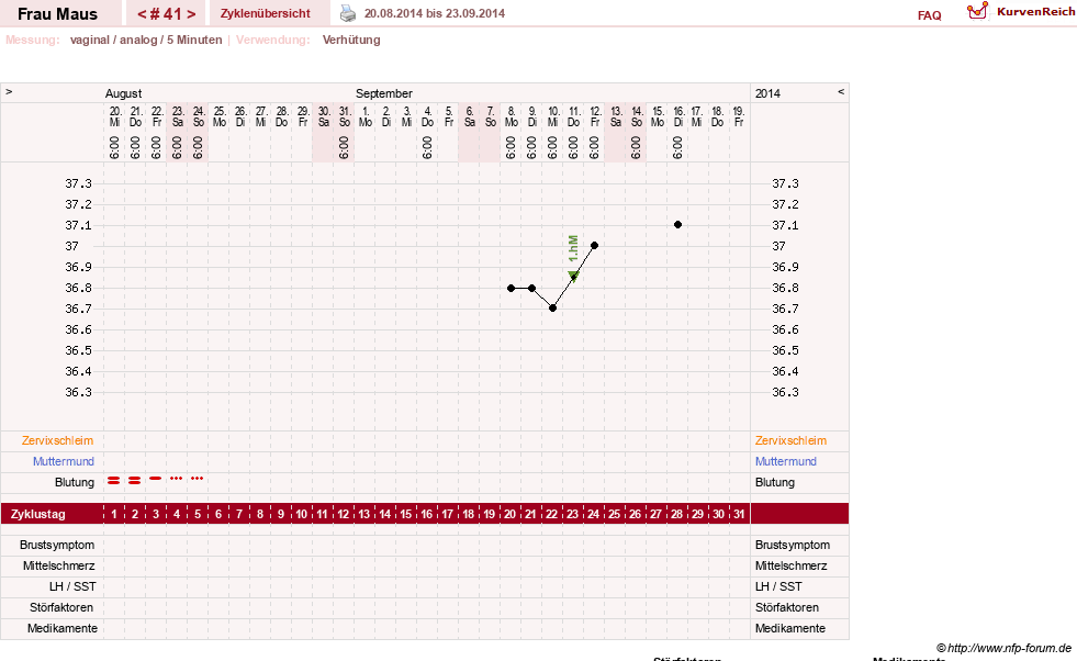 NFP-Kurve User #12121