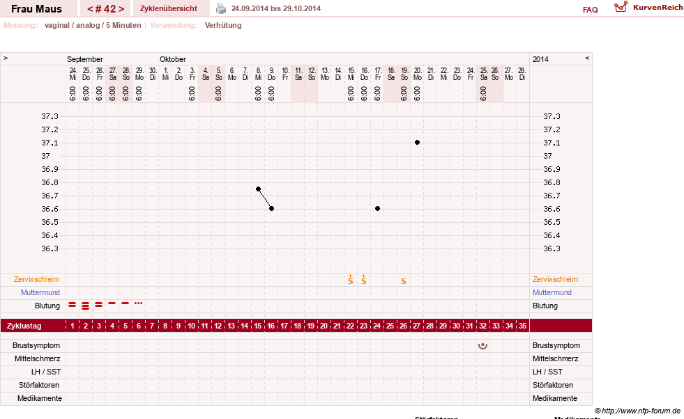 NFP-Kurve User #12121