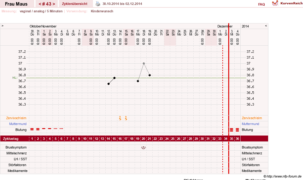 NFP-Kurve User #12121