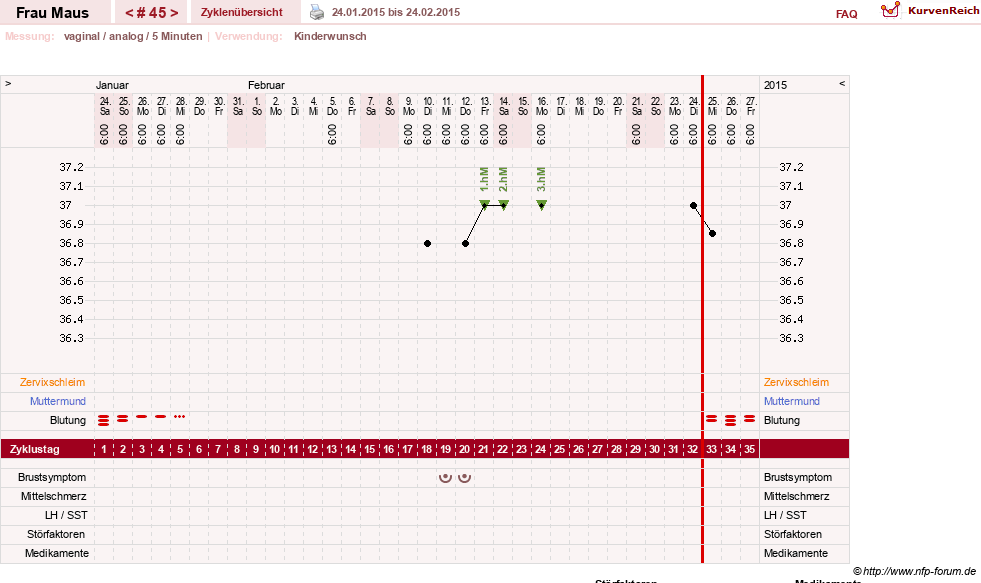 NFP-Kurve User #12121