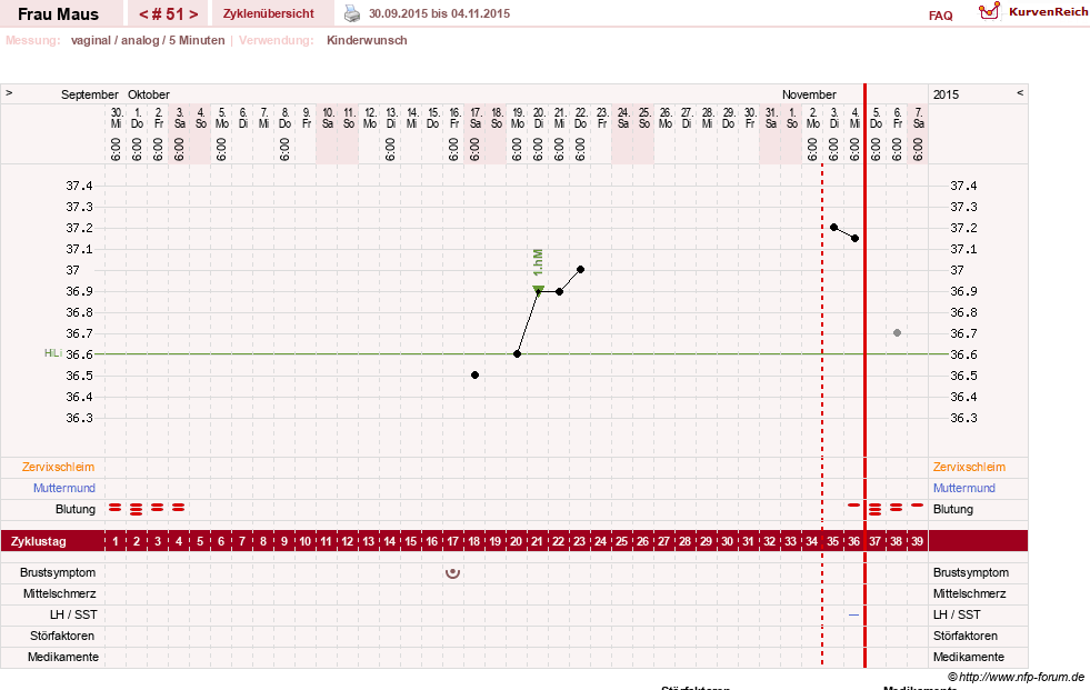 NFP-Kurve User #12121