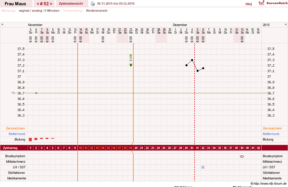 NFP-Kurve User #12121