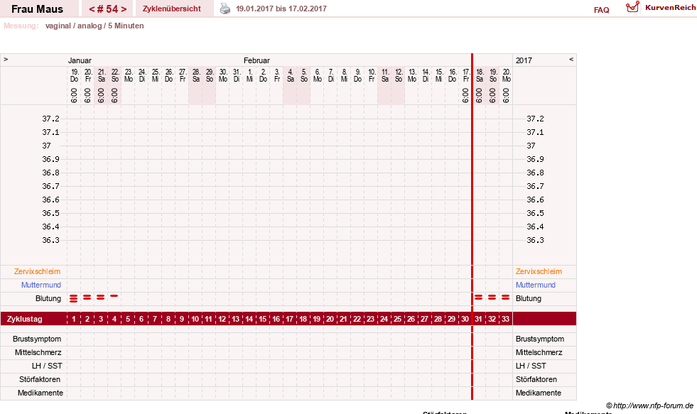 NFP-Kurve User #12121