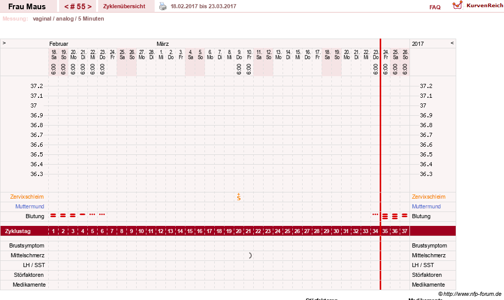 NFP-Kurve User #12121
