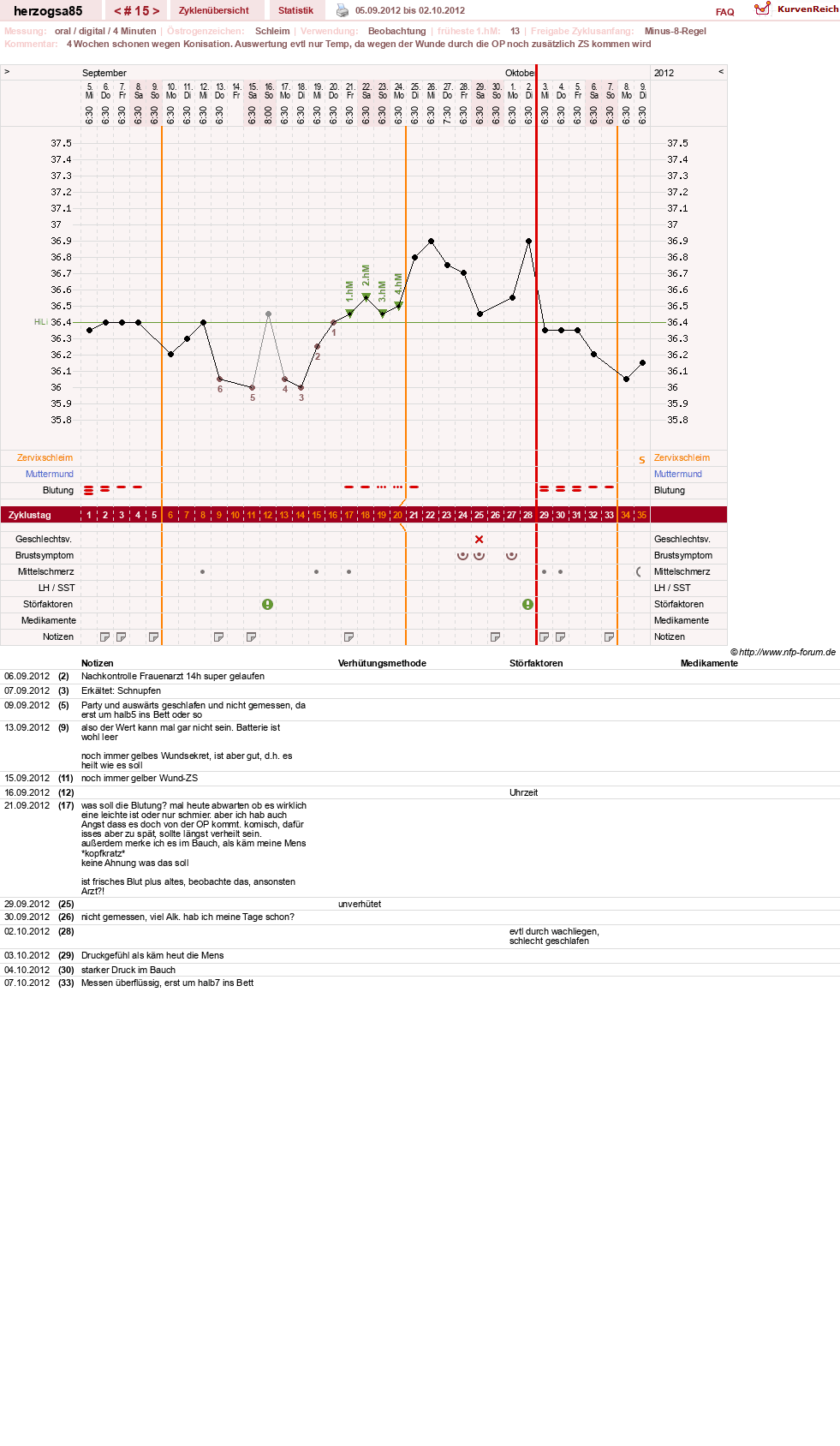 NFP-Kurve User #12122