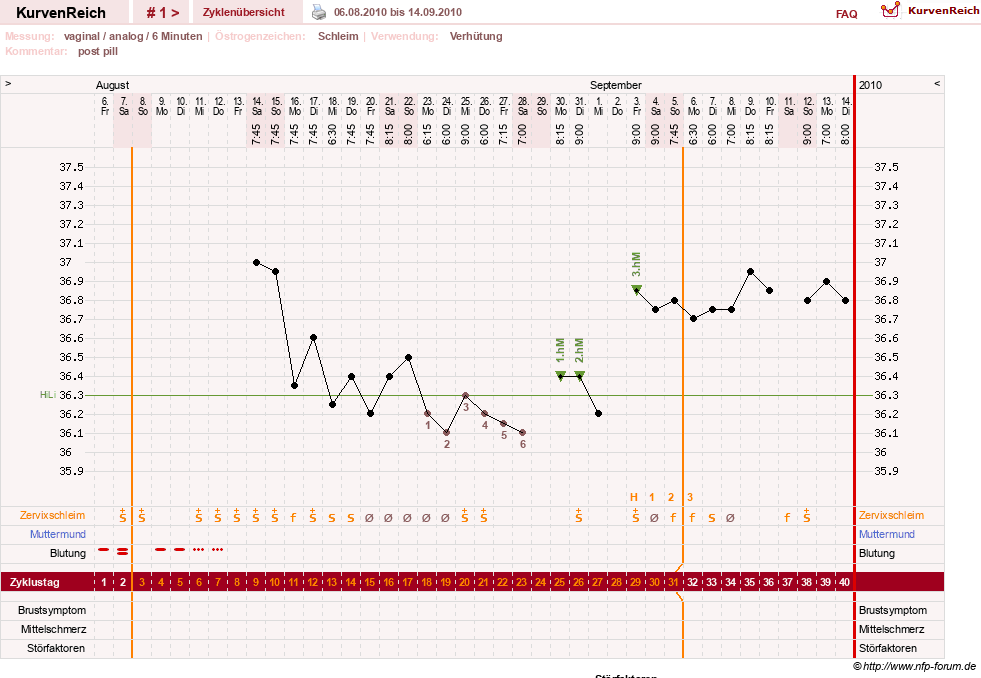 NFP-Kurve User #12240