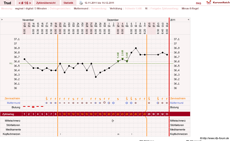 NFP-Kurve User #12271