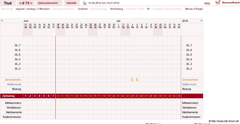NFP-Kurve User #12271