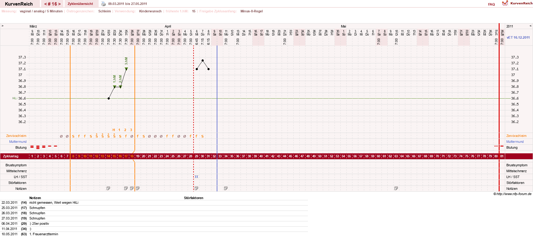 NFP-Kurve User #12544