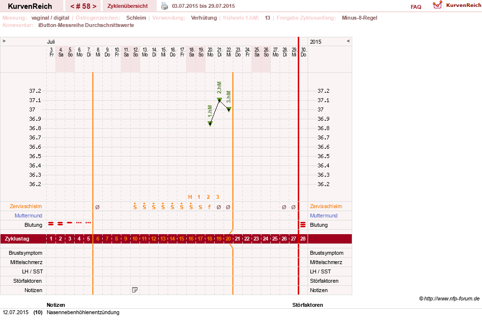 NFP-Kurve User #12544