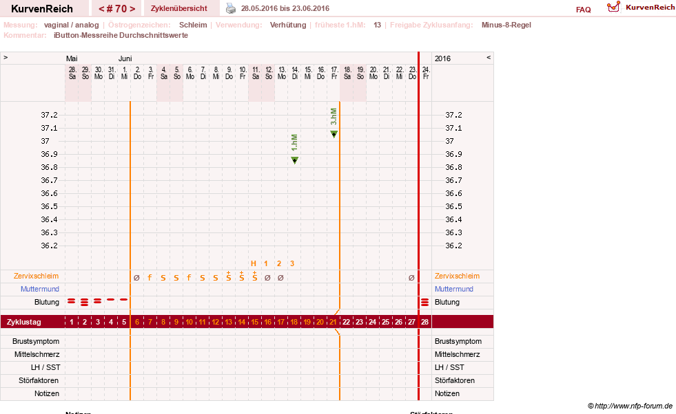 NFP-Kurve User #12544