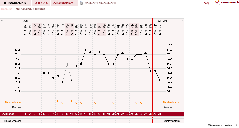 NFP-Kurve User #12962