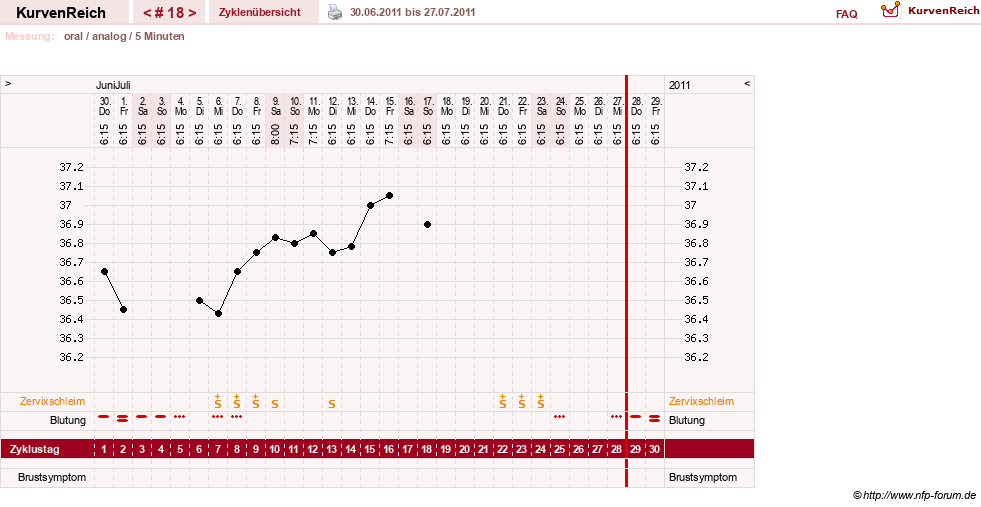 NFP-Kurve User #12962