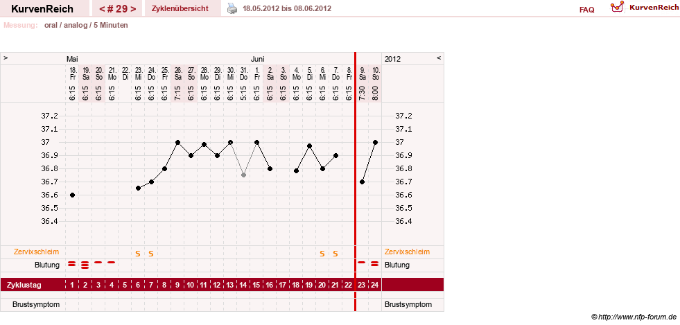 NFP-Kurve User #12962