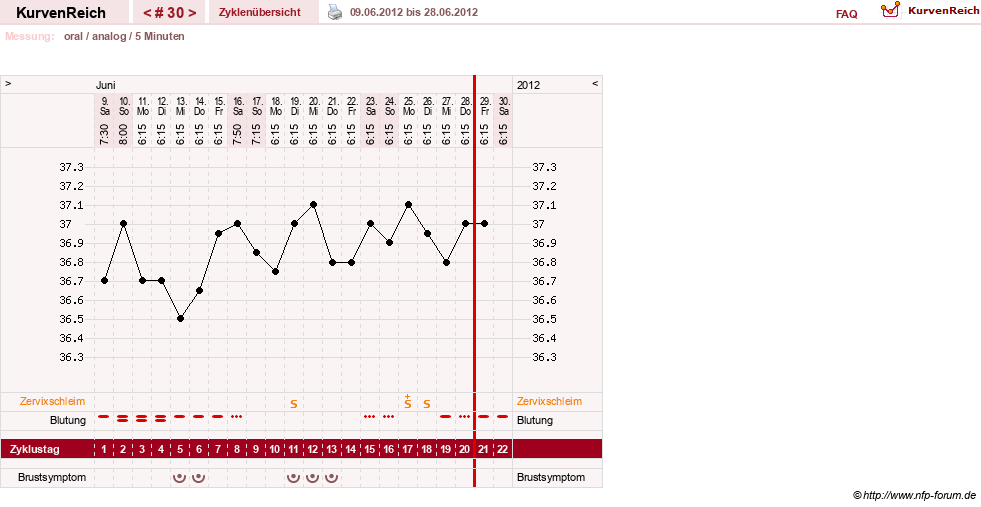 NFP-Kurve User #12962