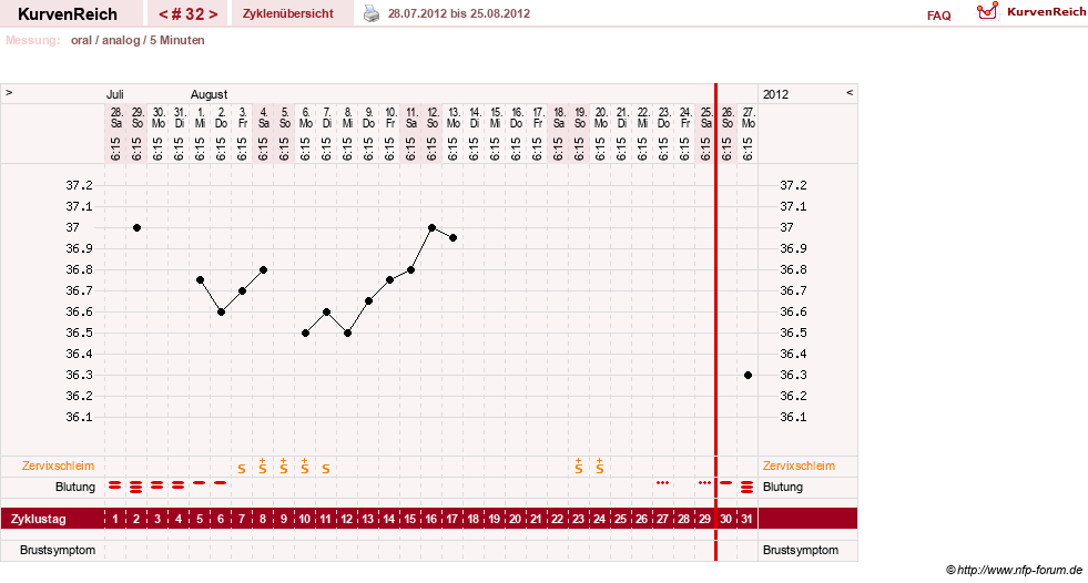 NFP-Kurve User #12962