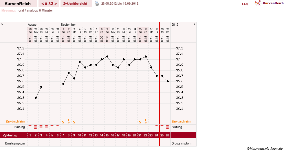 NFP-Kurve User #12962