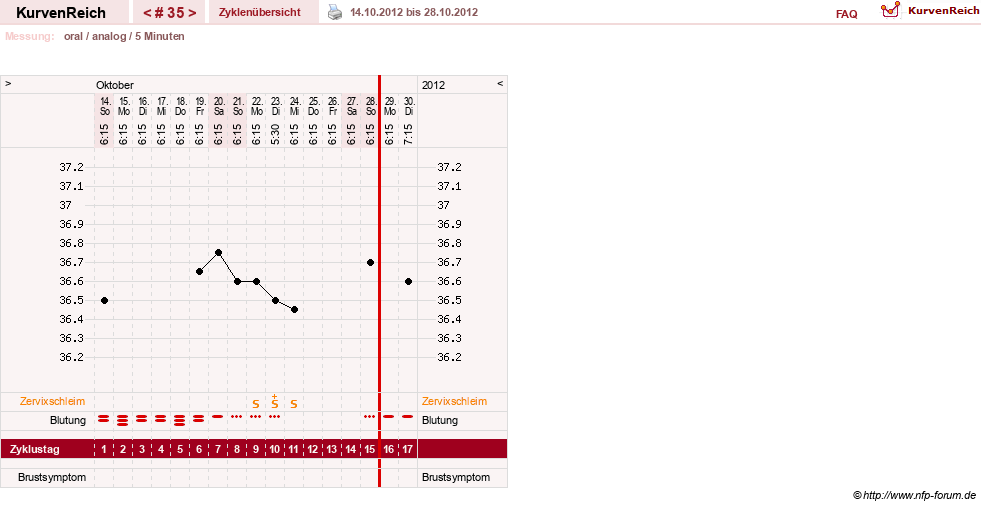 NFP-Kurve User #12962