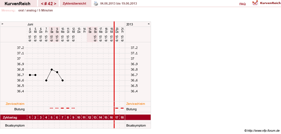 NFP-Kurve User #12962