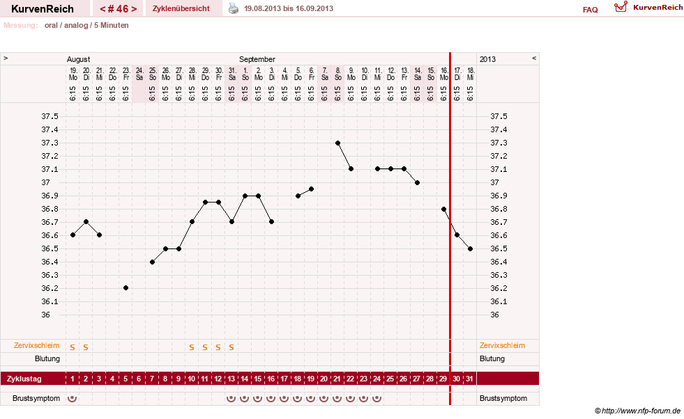 NFP-Kurve User #12962