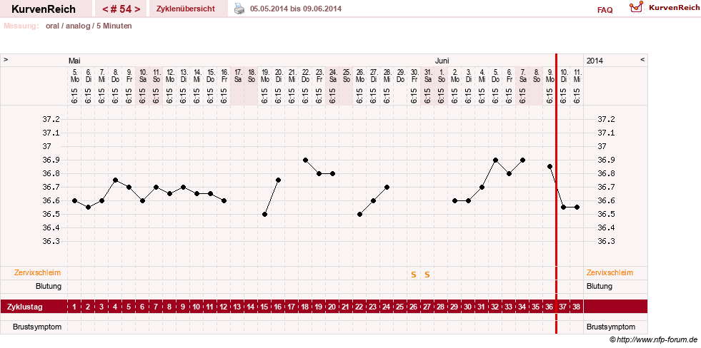 NFP-Kurve User #12962