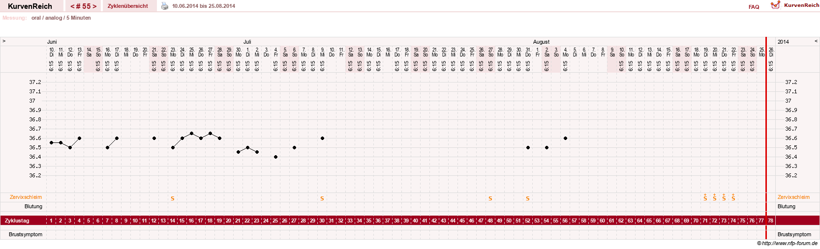 NFP-Kurve User #12962