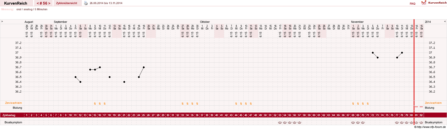 NFP-Kurve User #12962