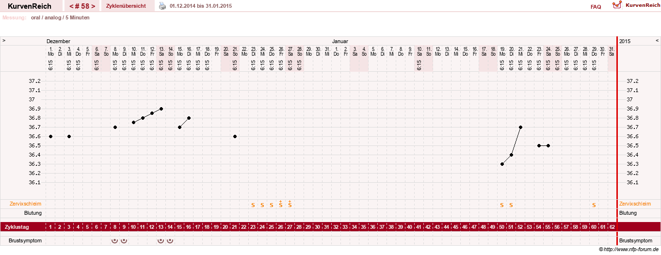 NFP-Kurve User #12962