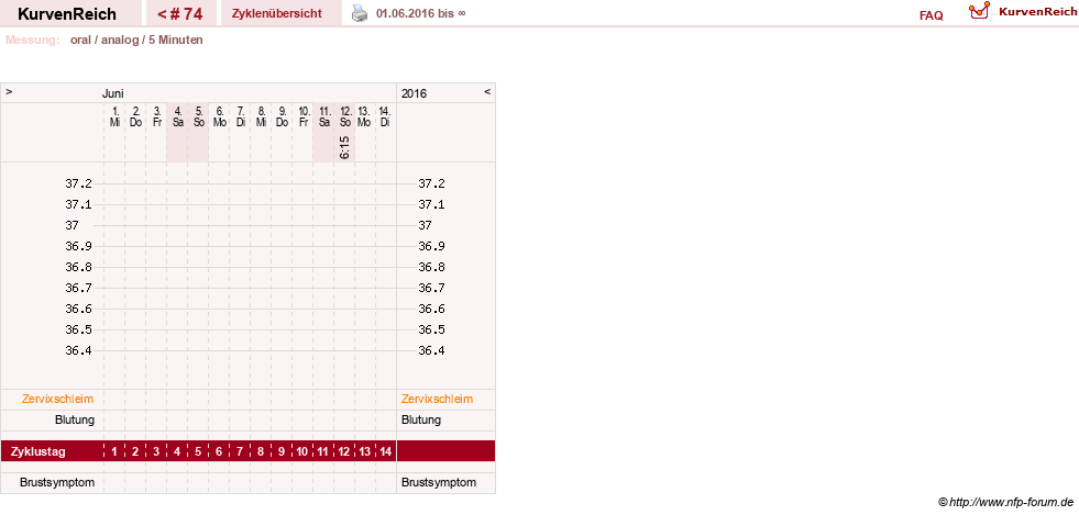 NFP-Kurve User #12962