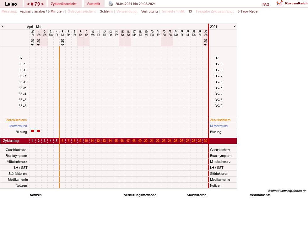 NFP-Kurve User #13255