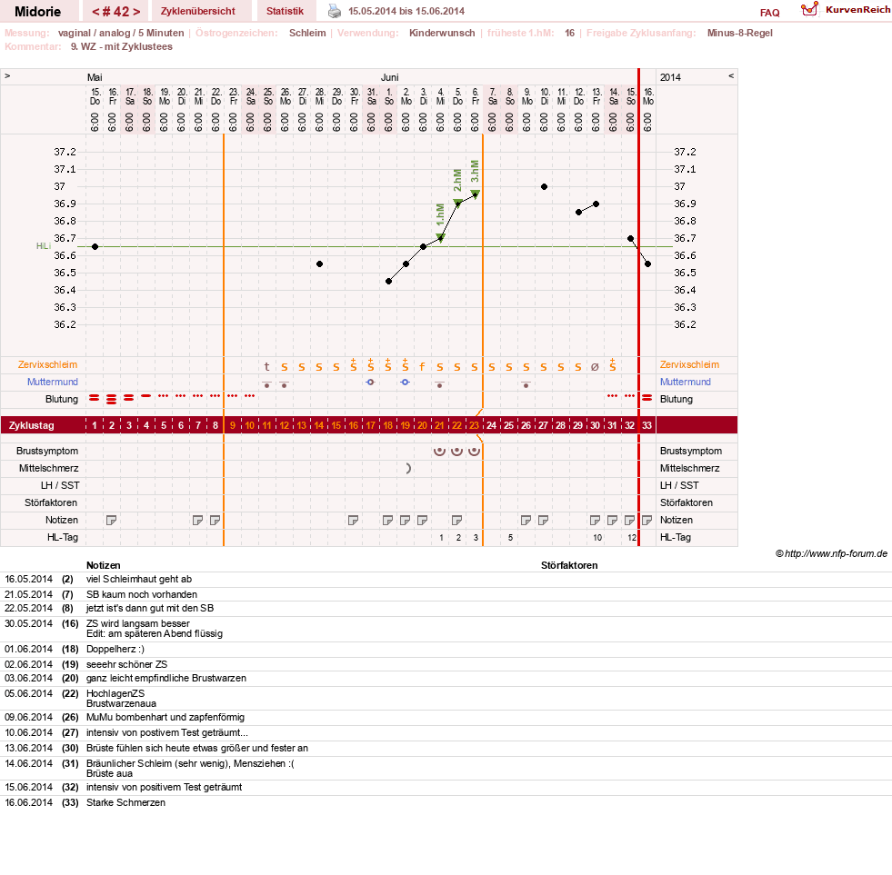 NFP-Kurve User #13275