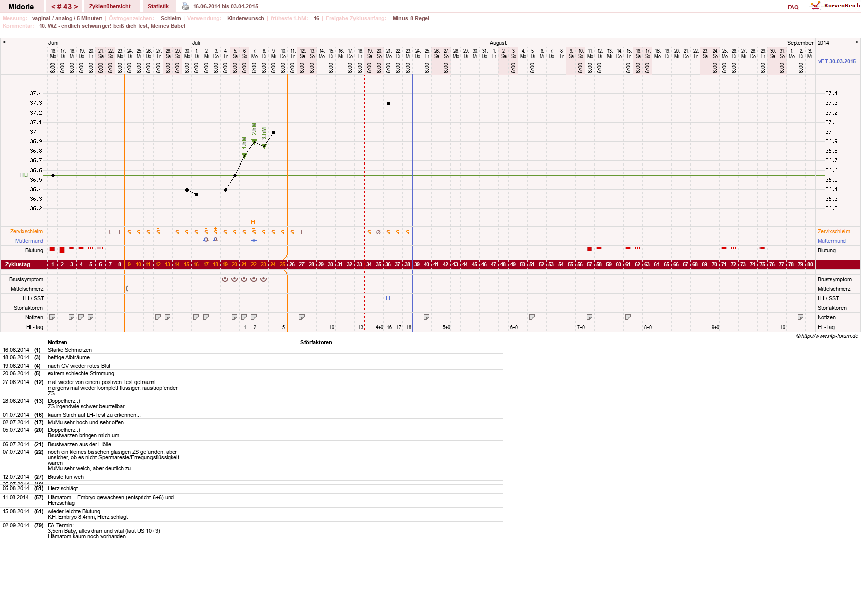 NFP-Kurve User #13275