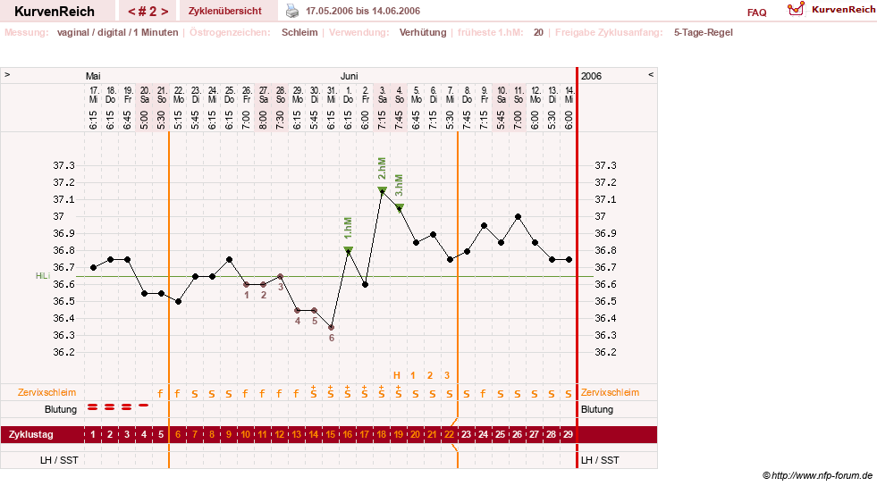 NFP-Kurve User #1373