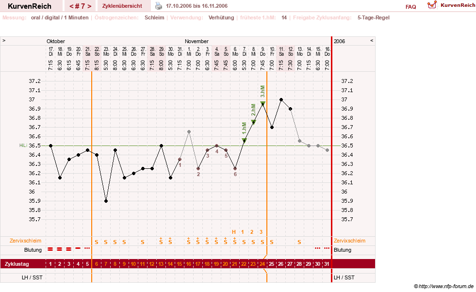 NFP-Kurve User #1373