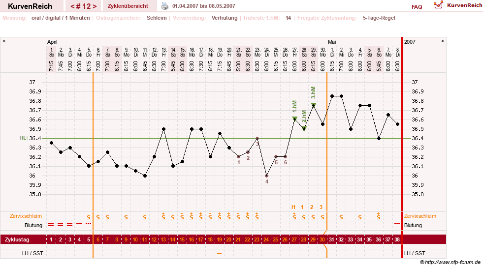 NFP-Kurve User #1373