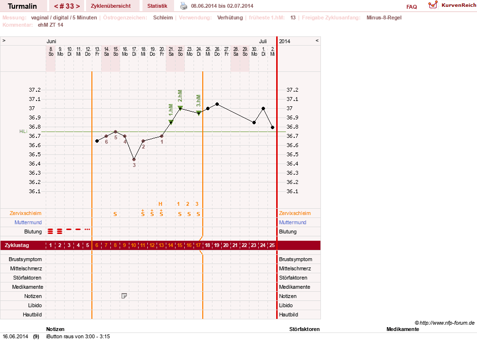 NFP-Kurve User #13733