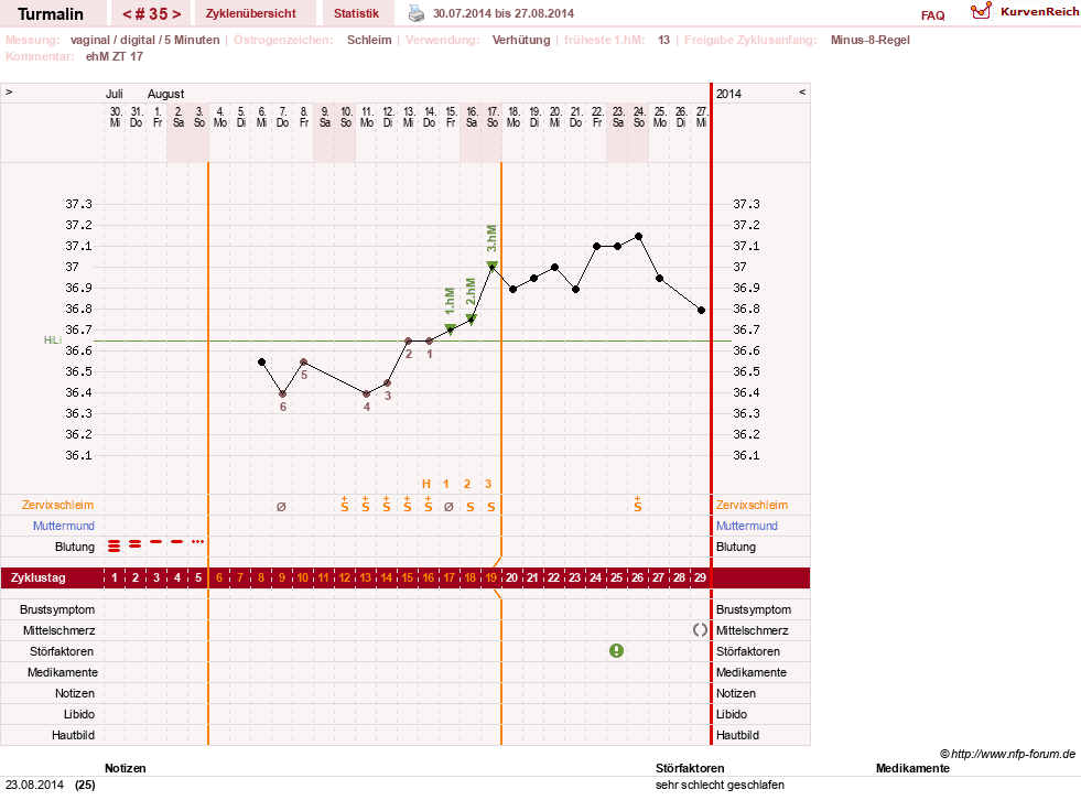 NFP-Kurve User #13733