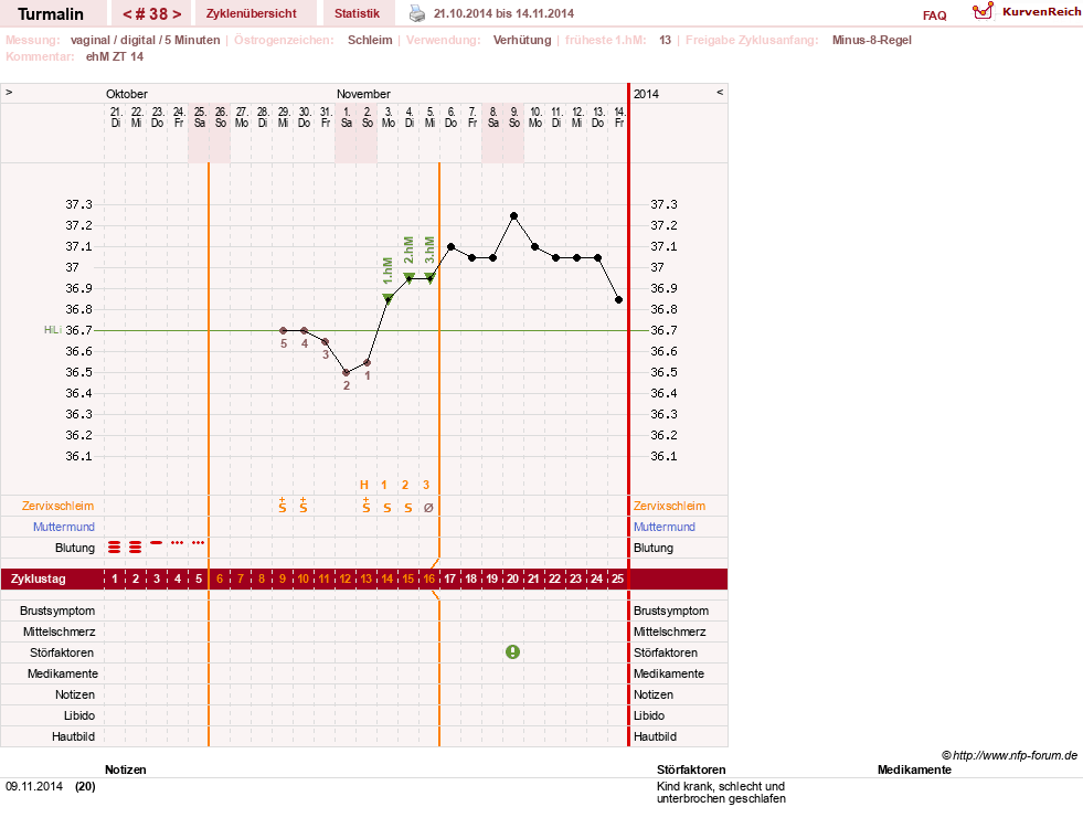 NFP-Kurve User #13733