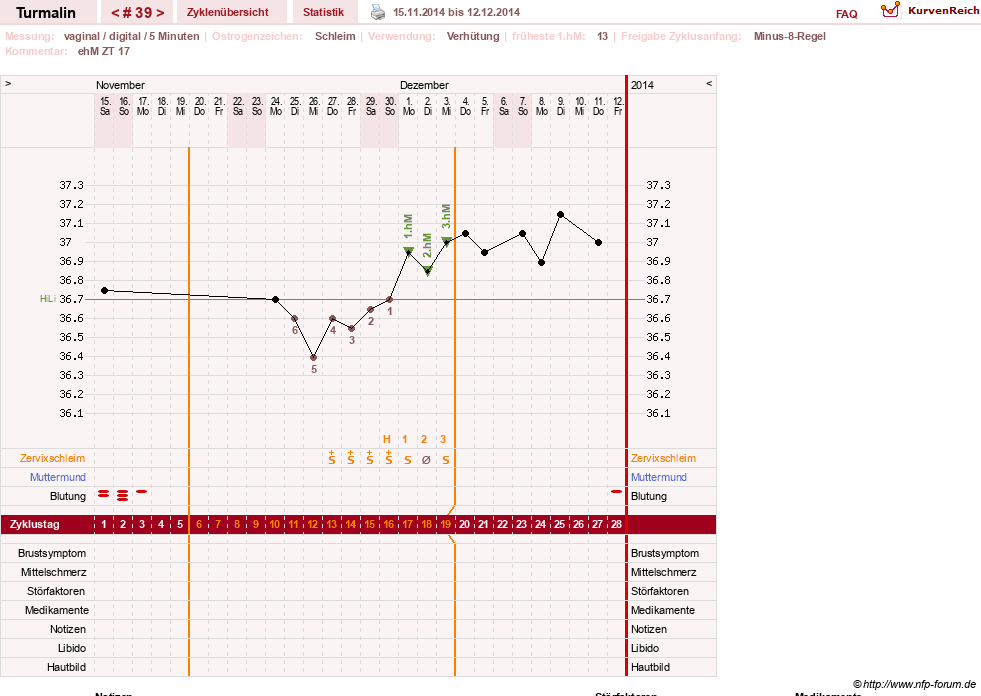 NFP-Kurve User #13733