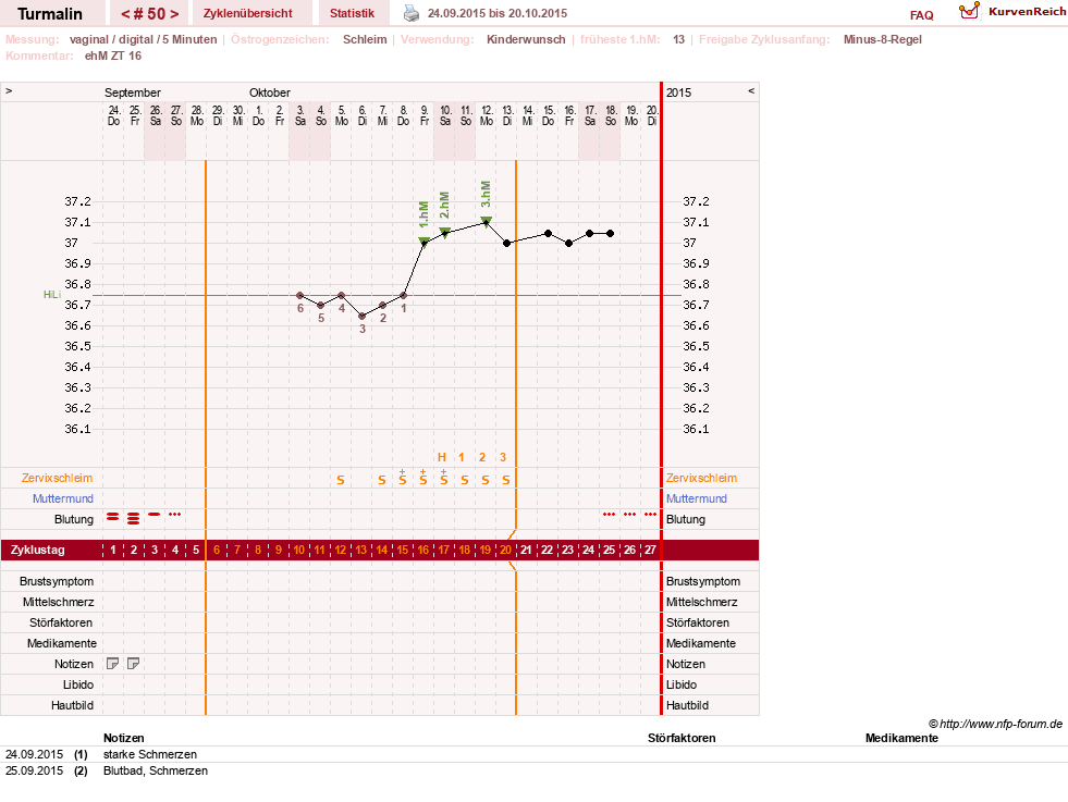 NFP-Kurve User #13733