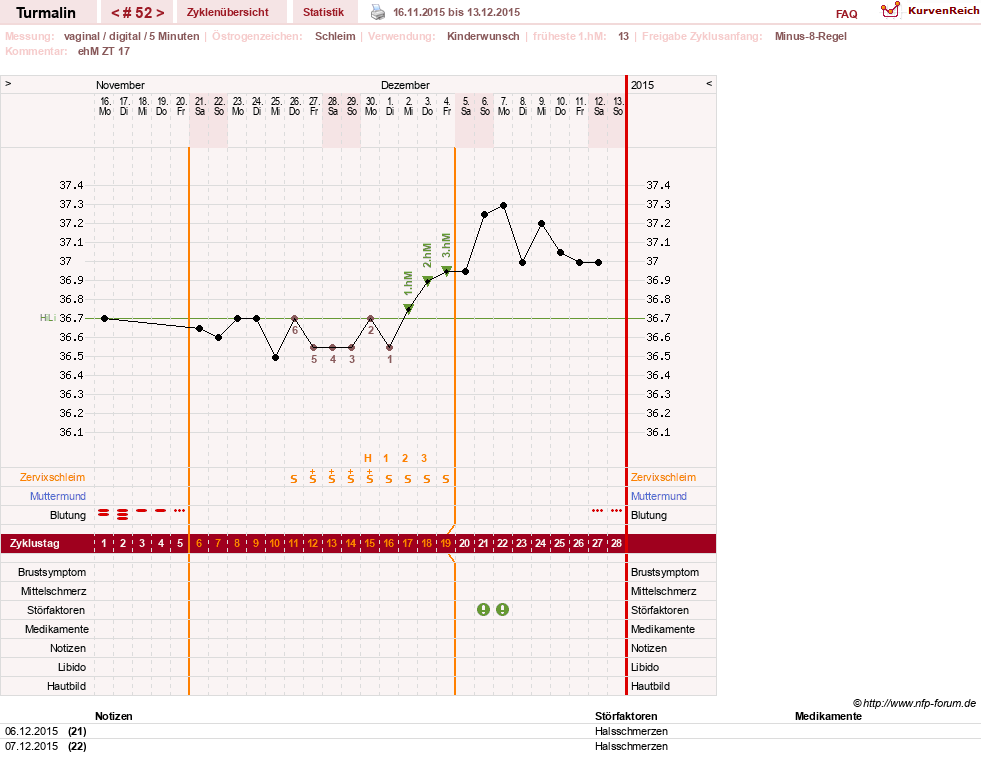 NFP-Kurve User #13733