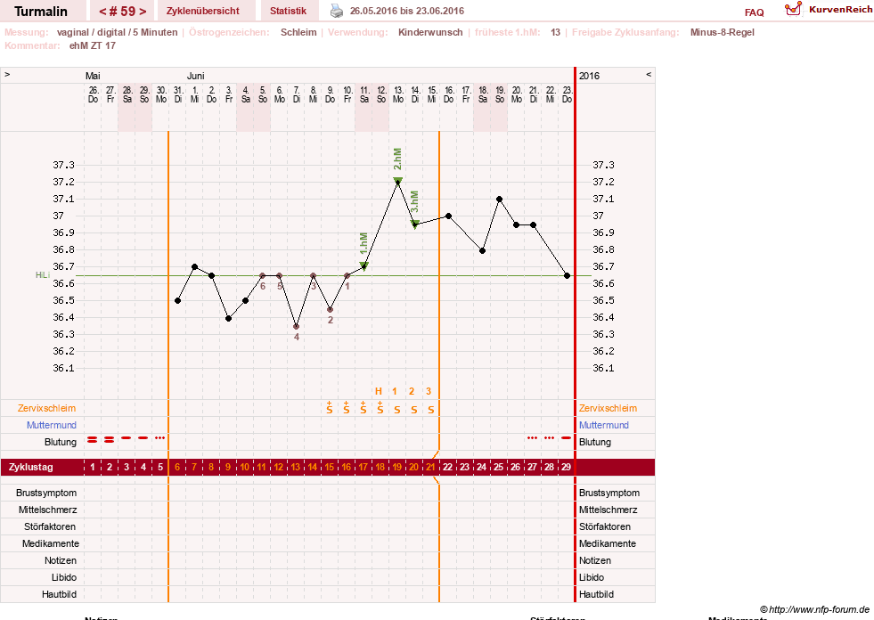 NFP-Kurve User #13733