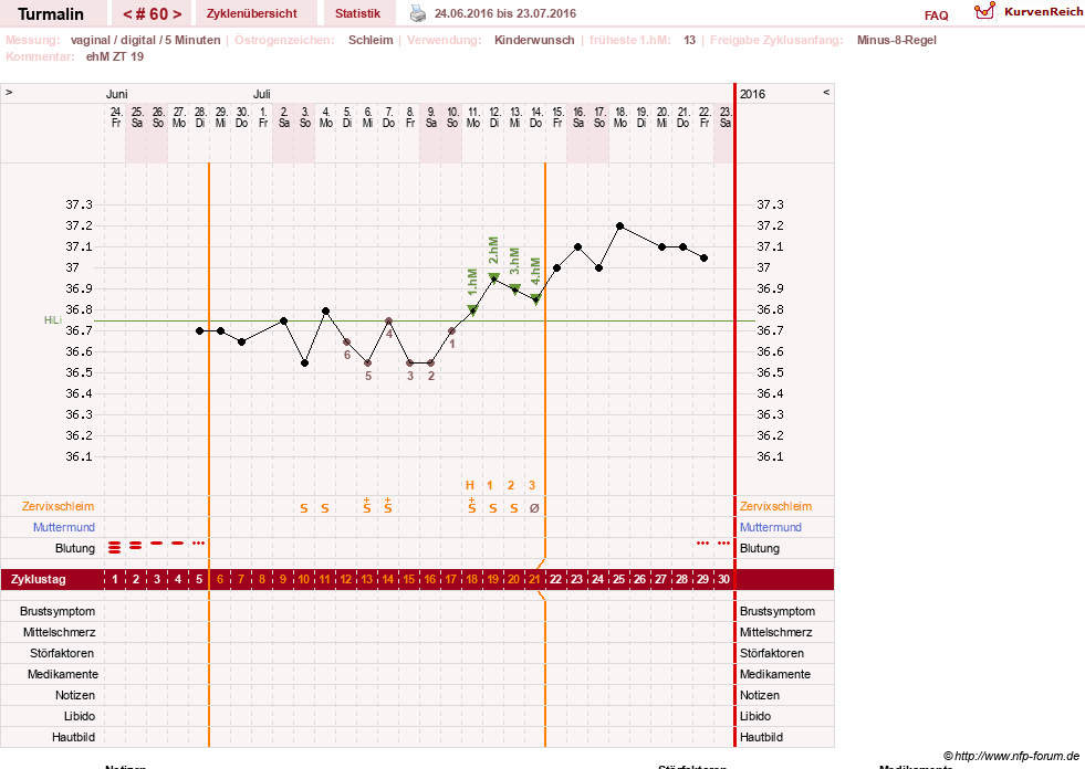 NFP-Kurve User #13733