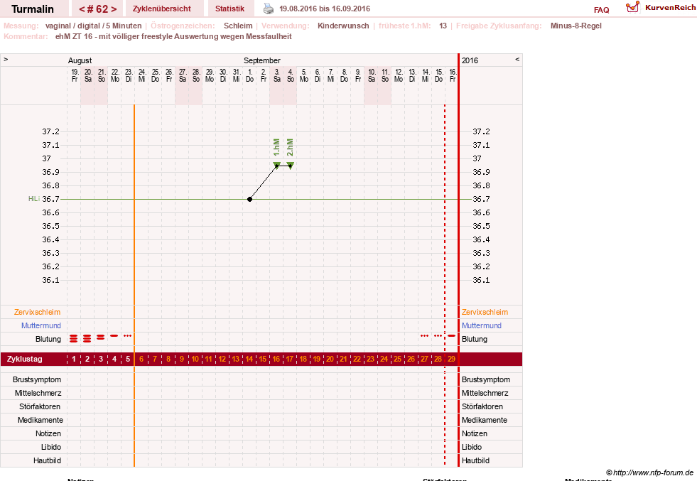NFP-Kurve User #13733