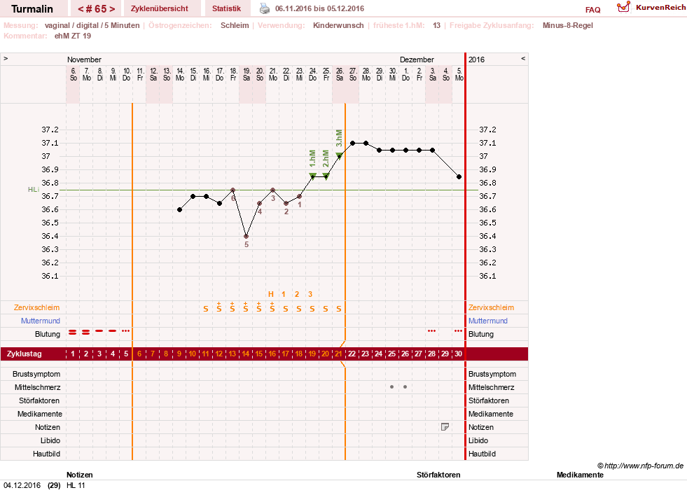NFP-Kurve User #13733