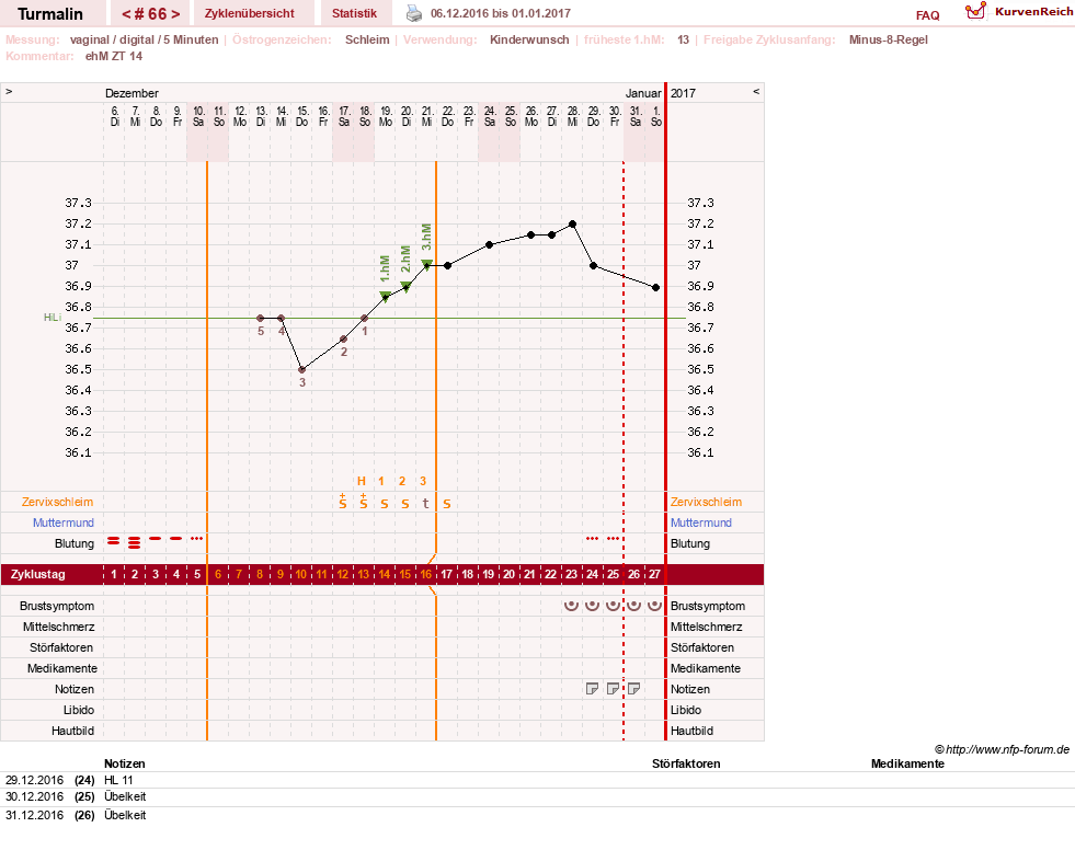 NFP-Kurve User #13733
