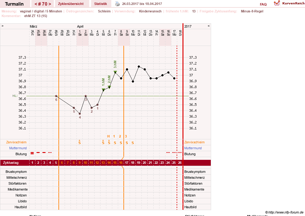 NFP-Kurve User #13733