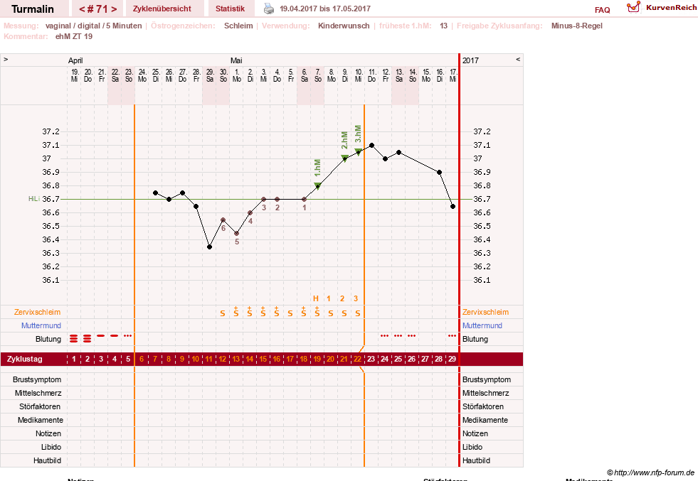 NFP-Kurve User #13733