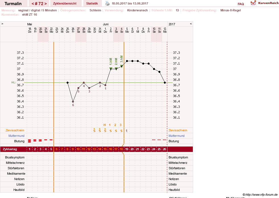 NFP-Kurve User #13733